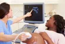 Woman getting pregnancy ultrasound.