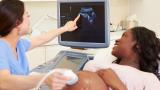 Woman getting pregnancy ultrasound.